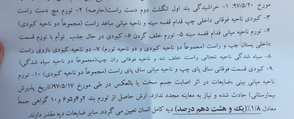 محاسبه دیه اعضای بدن